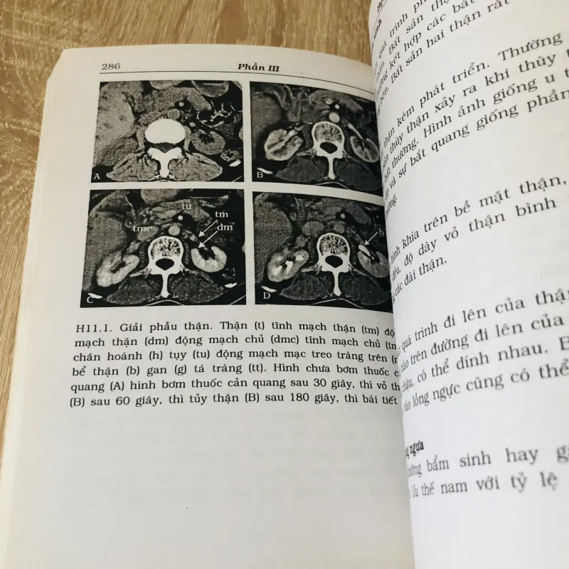 CT BỤNG & CHẬU 1017663