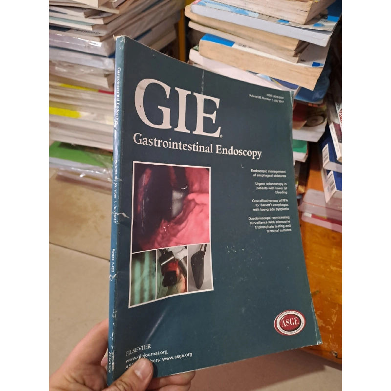 GIE Gastrointestinal Endoscopy volume 86 no 1 7/2017 HCM0808 TẠP CHÍ, THIẾT KẾ, THỜI TRANG 527266