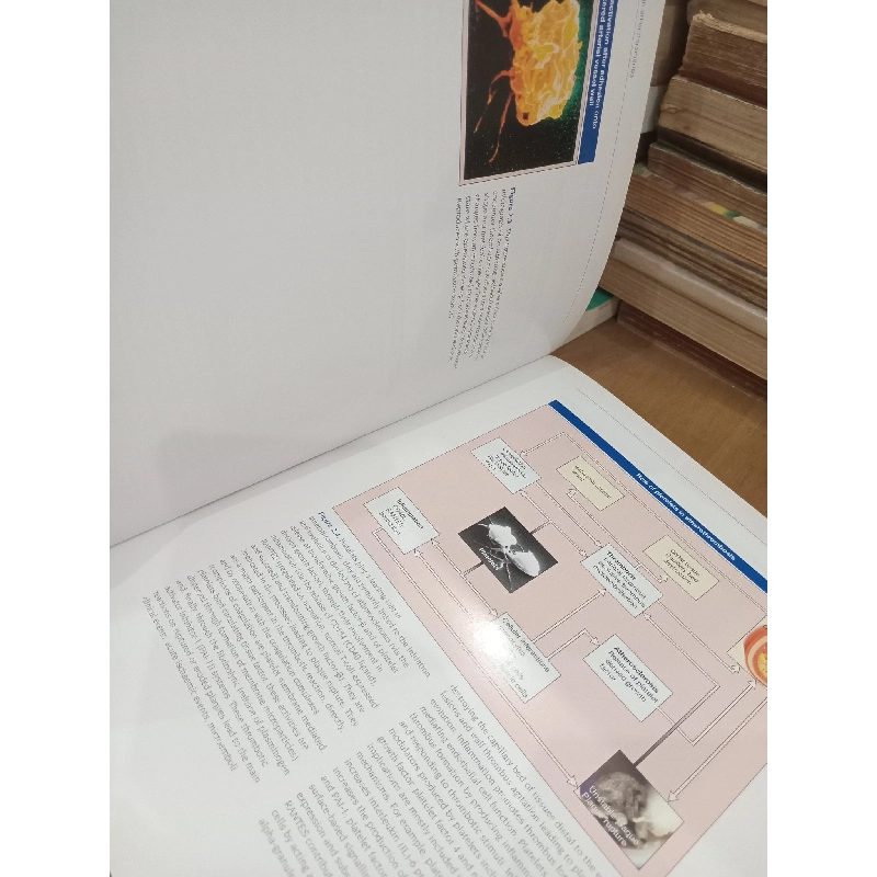 Atlas of Atherothrombosis - Editor-in-Chief: Eric J Topol 1024410