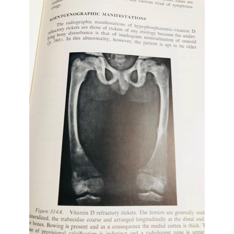 ORTHOPEDIC DISEASE  PHYSIOLOGY  PATHOLOGY  RADIOLOGY  470552
