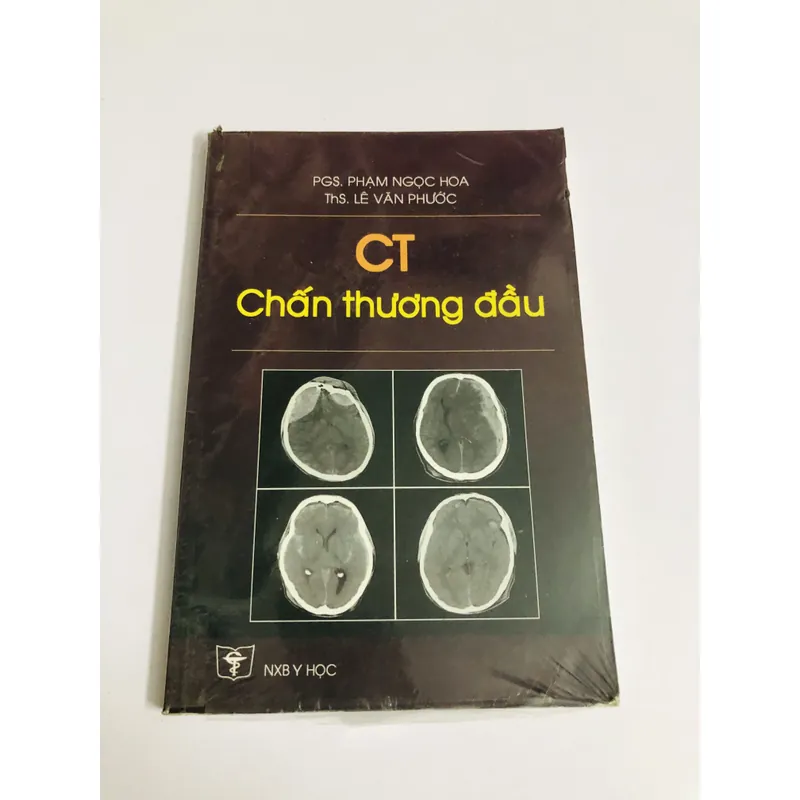 CT CHẤN THƯƠNG ĐẦU 675341