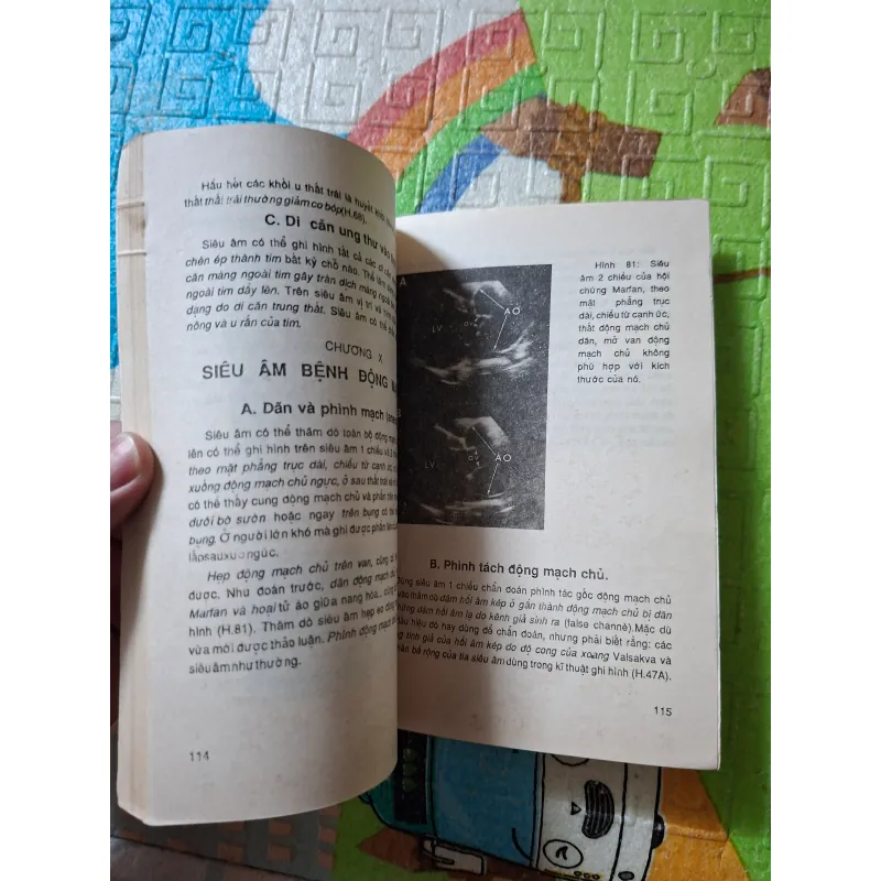 Chẩn đoán siêu âm các bệnh tim mạch 971636