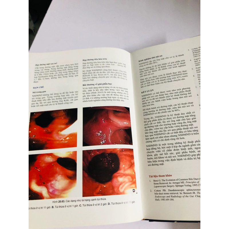 📚 SỎI ĐƯỜNG MẬT – Nguyễn Đình Hối, Nguyễn Mậu Anh 539457