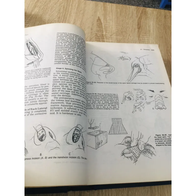 PLASTIC SURGERY – Volume 3: The Face (Part 2) 935091