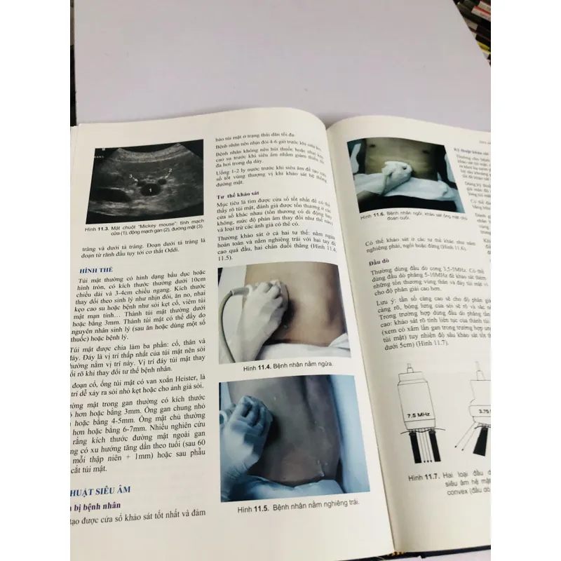 📘 SỎI ĐƯỜNG MẬT – Nguyễn Đình Hối & Nguyễn Mậu Anh 700887