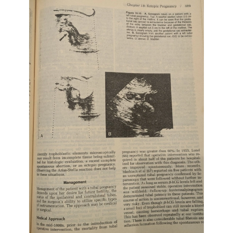 Novak's Textbook of Gynecology ( Eleventh Edition ) 1009444