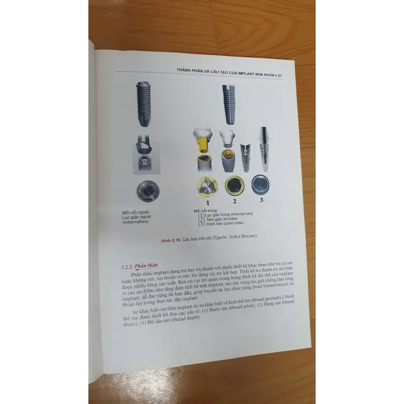 CẤY GHÉP NHA KHOA 740877