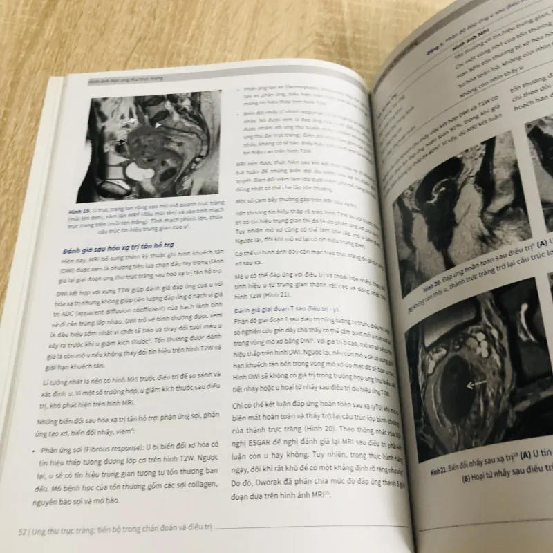 UNG THƯ TRỰC TRÀNG TIẾN BỘ TRONG CHẨN ĐOÁN & ĐIỀU TRỊ  412240