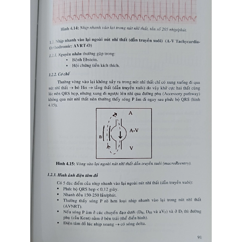 Loạn nhịp tim trong lâm sàng: Chẩn đoán và điều trị - PGS.TS.BS. Hoàng Quốc Hòa 1006481