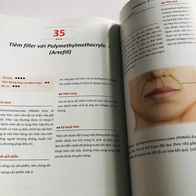 KỸ THUẬT TIÊM THẨM MỸ  600130