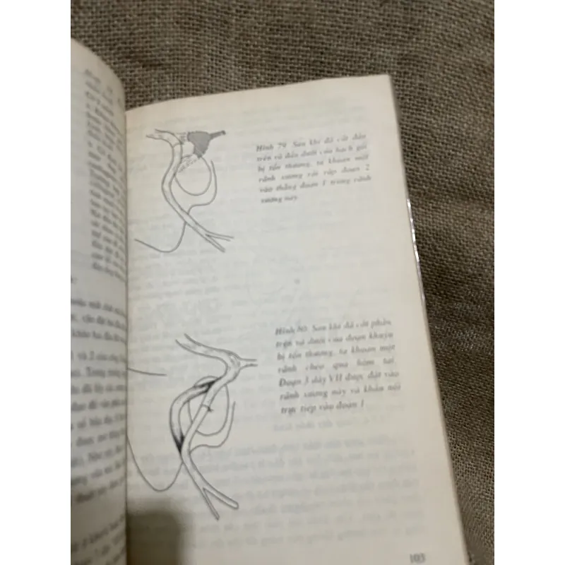 Điều trị liệt mặt - bác sĩ Nguyễn Tấn Phong - sách y khổ lớn  989694