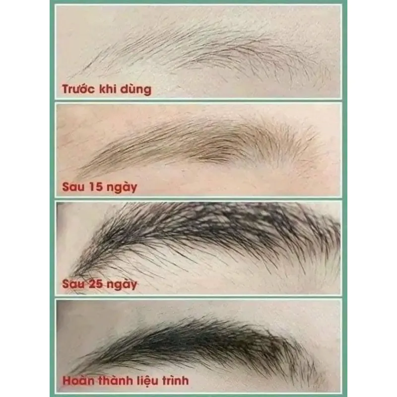 Dưỡng dày mày 971553