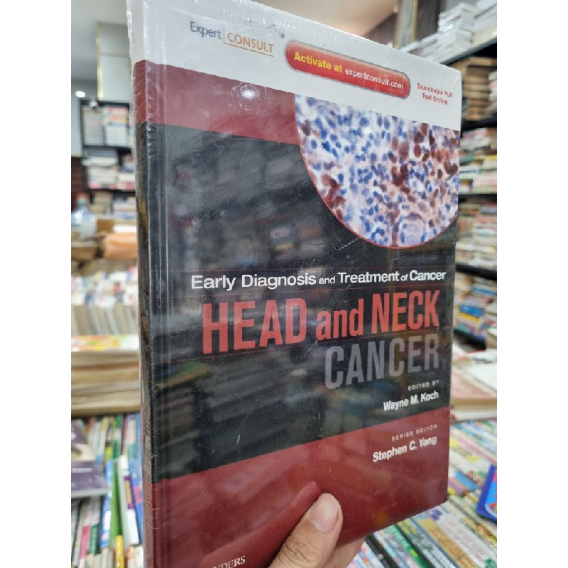 HEAD AND NECK CANCER : EARLY DIAGNOSIS AND TREATMENT OF CANCER - WAYNE M. KOCH (EDITED) 120161