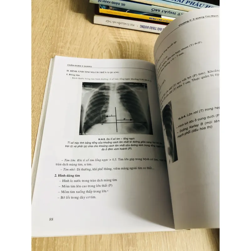 BÀI GIẢNG CHẨN ĐOÁN X QUANG 1013046