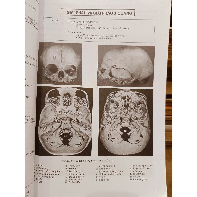Hình ảnh học sọ não - Jacques Clarisse, Nguyễn Thi Hùng, Phạm Ngọc Hoa 929913