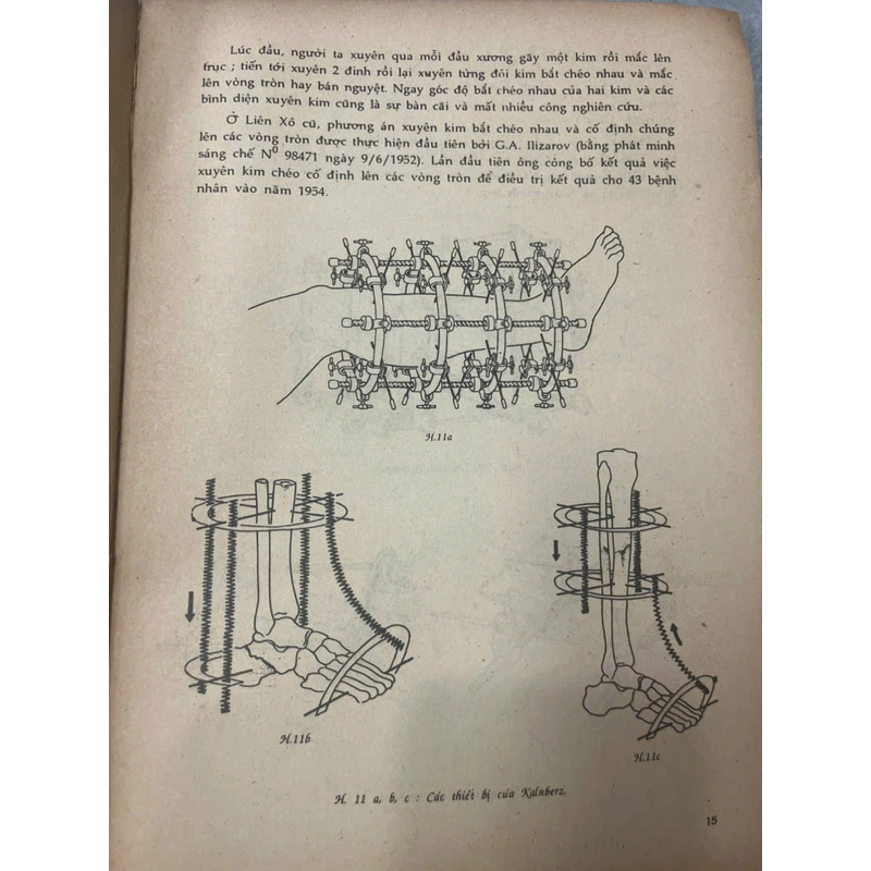 MỘT SỐ KỸ THUẬT MỚI TRONG CHẤN THƯƠNG CHỈNH HÌNH 542135