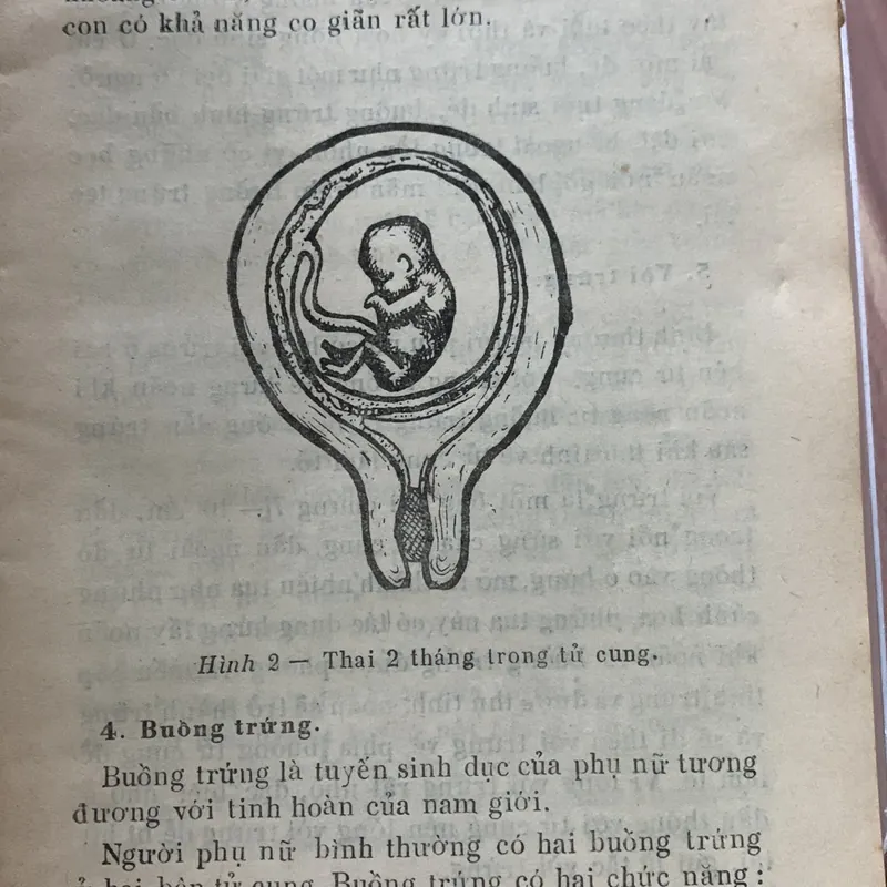 Những bệnh phụ khoa thông thường, Dương Thị Cương 622727