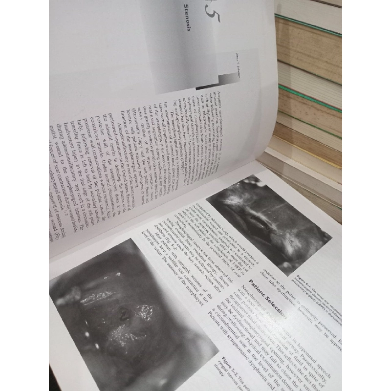 Operative otolaryngology: Head and neck surgery - Eugene N. Myers 792180