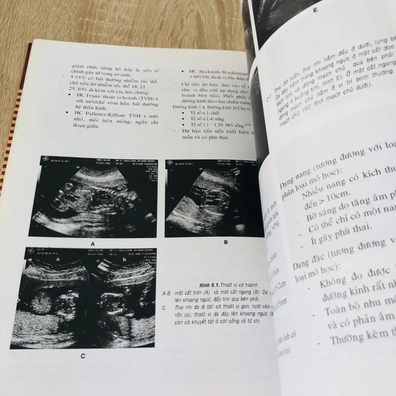 SIÊU ÂM SẢN KHOA THỰC HÀNH  974763