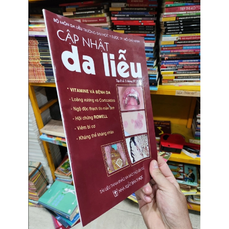 Cập Nhật Da Liễu - Bộ Môn Da Liễu Trường Đại Học Y Dược TP.Hồ Chí Minh 1035065
