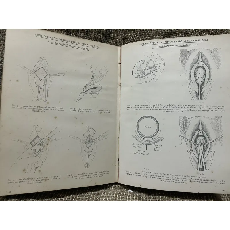 Kthuật phẫu thuật bằng hình ảnh -TECHNIQUE CHIRURGIEALE EN FIGURES G.JEANNENEY& J.MAGENDIE 1006345