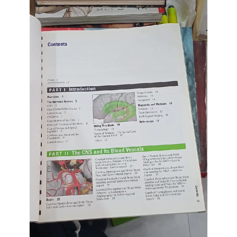 The Brain Atlas - Thomas A. Woolsey, Josepb Hanaway, Mokbstar H. Gado 696706