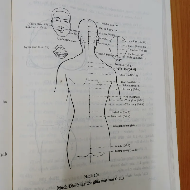 CHÂM CỨU HỌC Trung QUỐC  674270