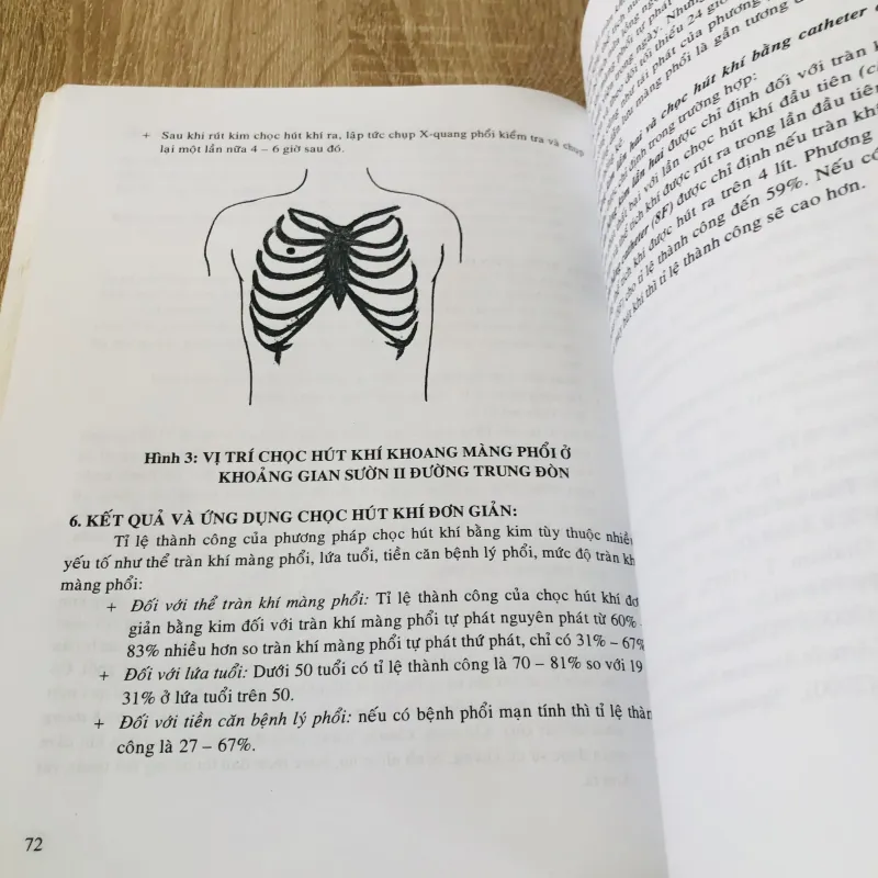 MỘT SỐ THỦ THUẬT TRONG LAO VÀ BỆNH PHỔI 933208