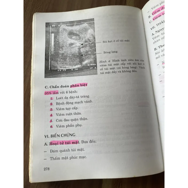 Bệnh học & Điều trị học Ngoại khoa, tiêu hóa  796935