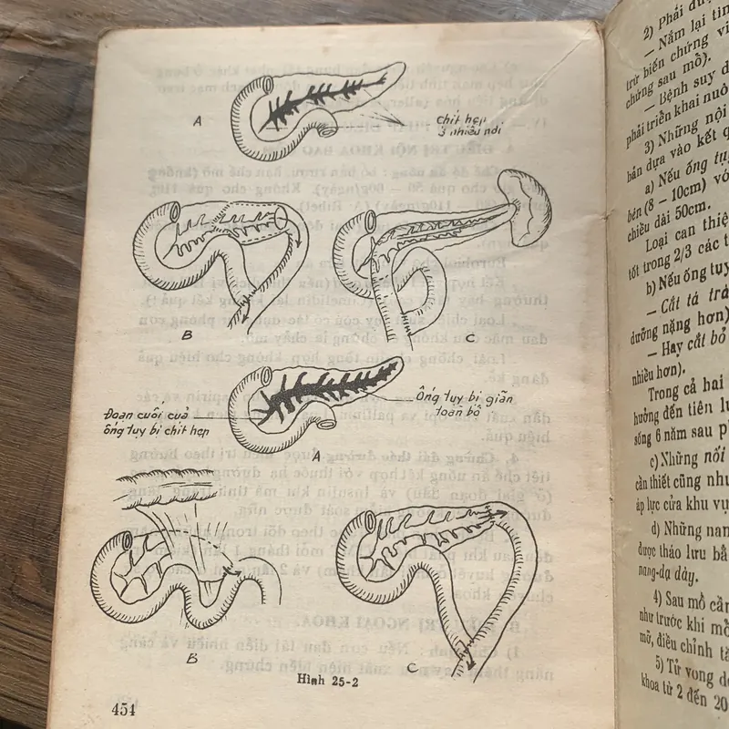 Bài giảng Bệnh học Ngoại khoa tập 1, lưu hành nội bộ, in năm 1991, 457 trang 717416