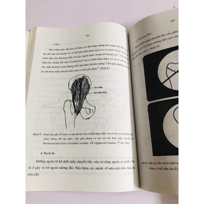 CHẤN THƯƠNG HỌC VÙNG HÁNG ( Lê Phúc ) 539414