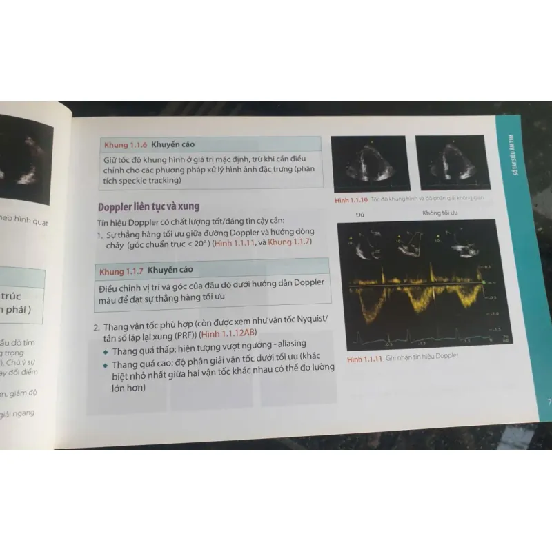 Sổ Tay Siêu Âm Tim - Patrizio Lancellotti, Bernard Cosyns mới 90% 752435