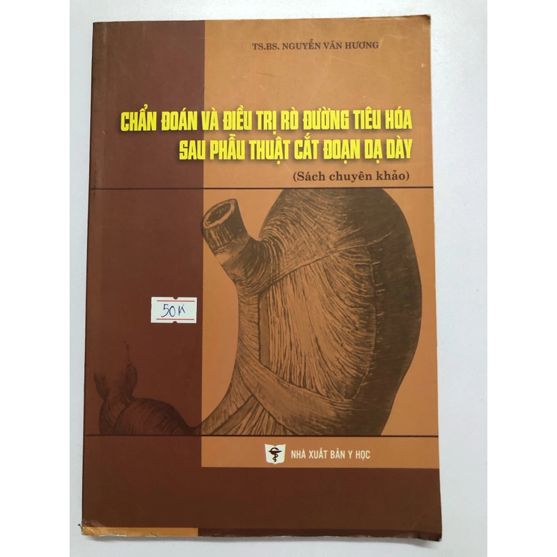 CHẨN ĐOÁN VÀ ĐIỀU TRỊ RÒ ĐƯỜNG TIÊU HÓA SAU PHẪU THUẬT CẮT ĐOẠN DẠ DÀY  315401