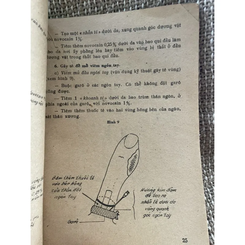 Phương pháp gây tê - GS Trương Công Trung  1025097