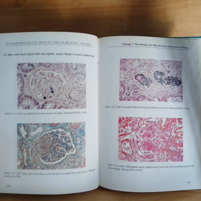 Atlast Mô Bệnh Học Các Bệnh Cầu Thận & Bệnh Ống - Kẽ Thận 799329