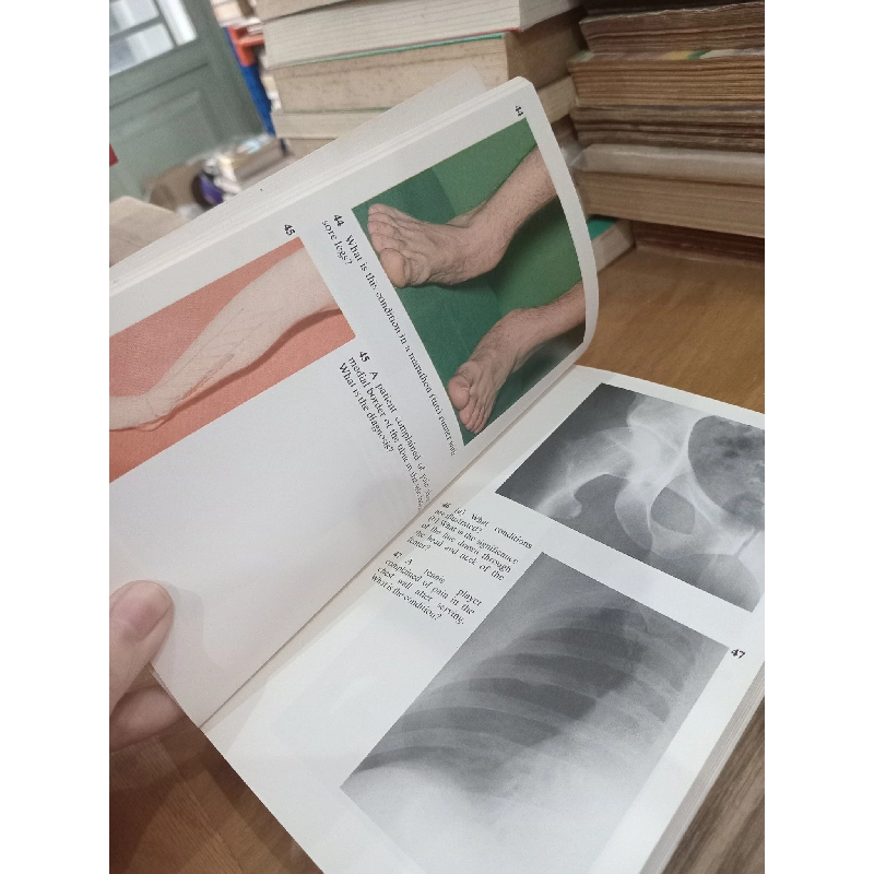 Diagnostic picture tests in injury in sport - J.G.P. Williams 1026695