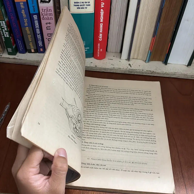 II Sách Y Học: Bài Giảng _ Sản Phụ Khoa - 1992 602627