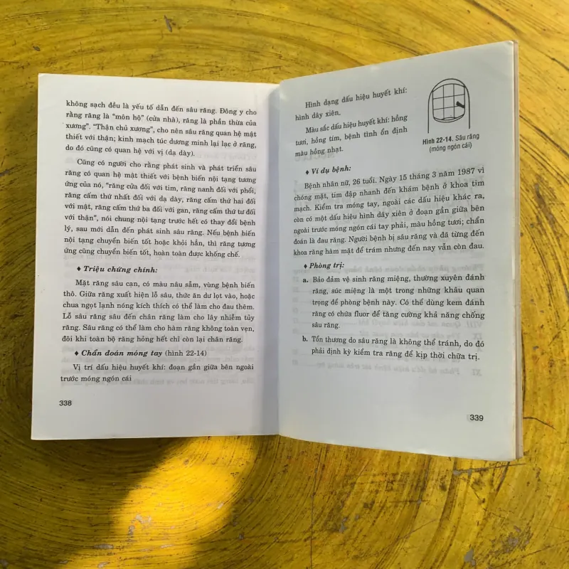 COMBO CHẨN ĐOÁN BỆNH QUA MÓNG TAY & CHỮA BỆNH BẰNG ĐỒ HÌNH PHẢN CHIẾU & ĐỒNG ỨNG 991279