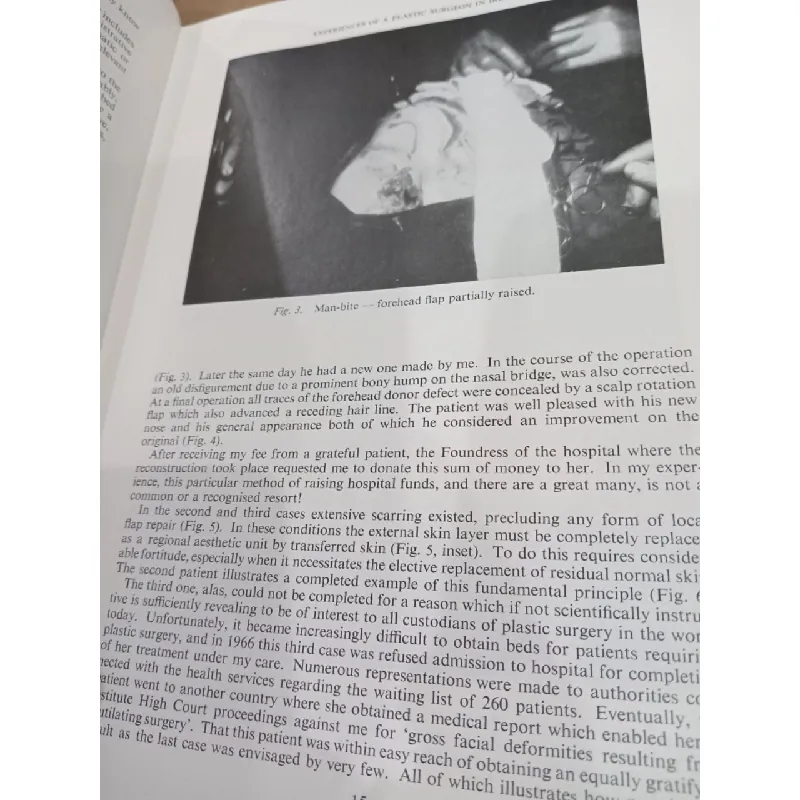 Transactions of the fourth international congress of plastic and reconstructive surgery 556684