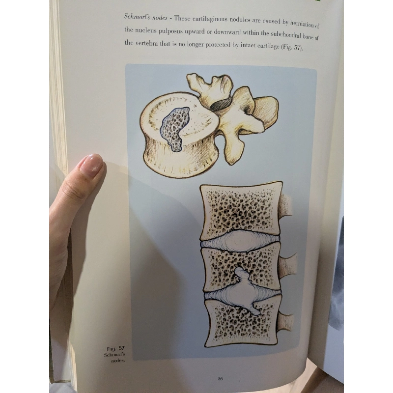 Bone and joint imaging - Francesco Priolo 974444