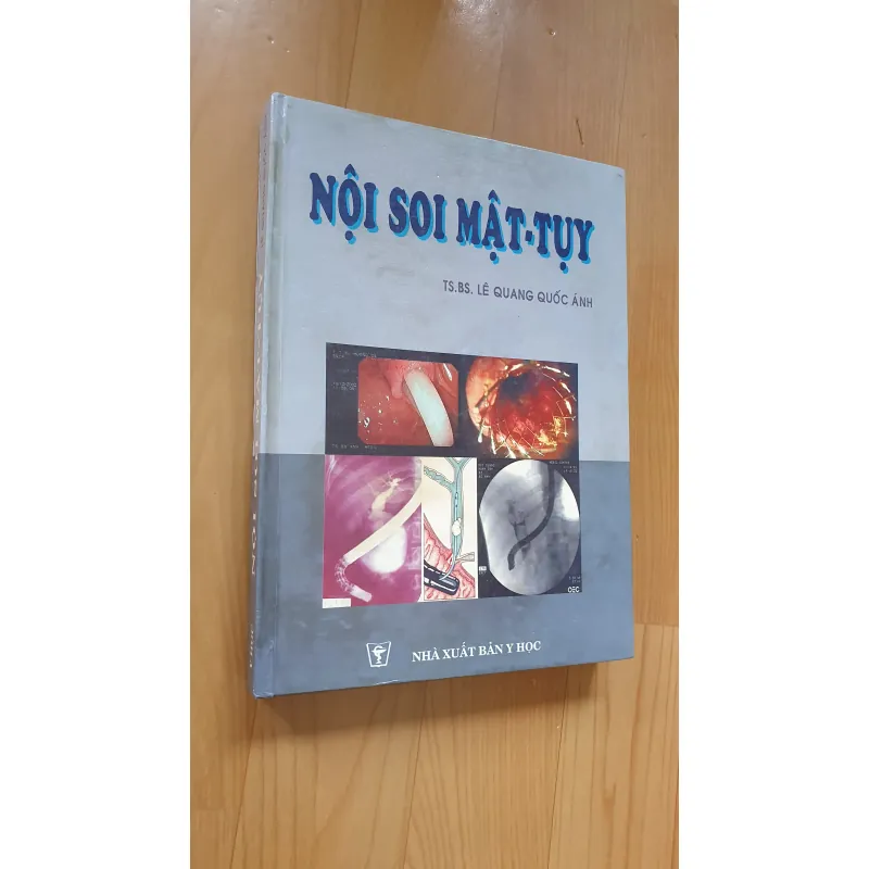 NỘI SOI MẶT TUY  754032
