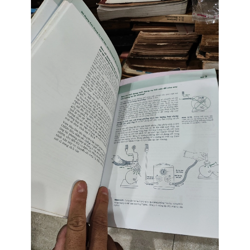 Hồi Sức Cấp Cứu Sơ Sinh 1033496