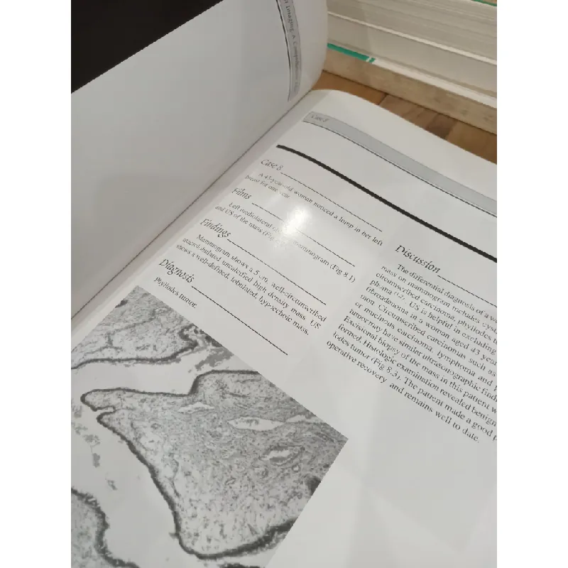 Breast Imaging: A Comprehensive Atlas - Malai Muttarak 703644