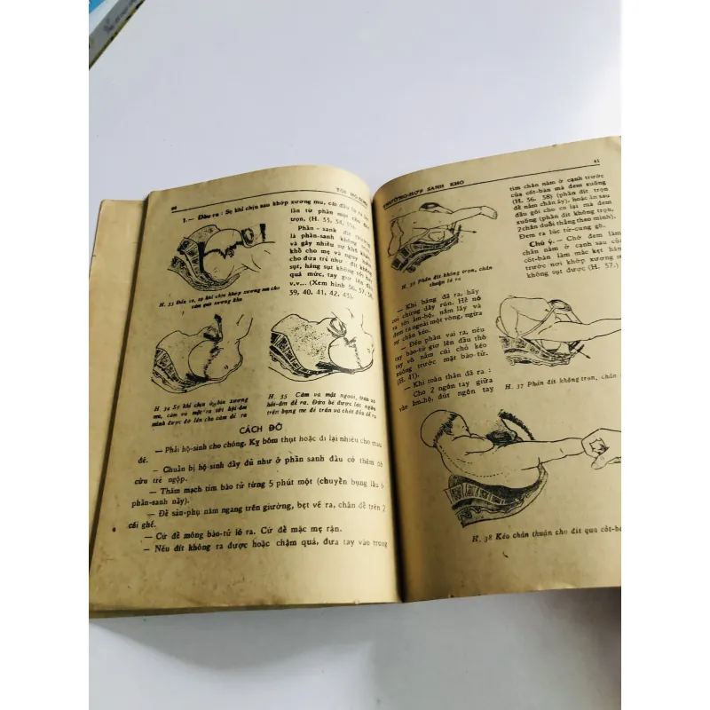 TÔI HỘ SINH Nguyên lý – thực nghiệm Sản khoa V.N. Hoàng & Linh-Ba 78 trang, NXB: 1970 796468