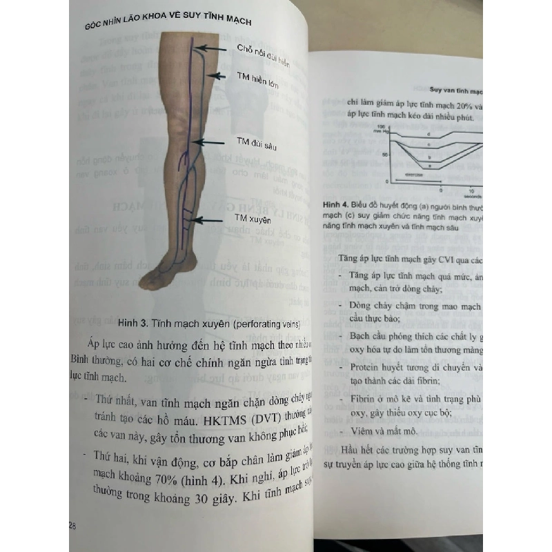 Góc nhìn lão khoa về suy tĩnh mạch - Nguyễn Văn Trí 1012987