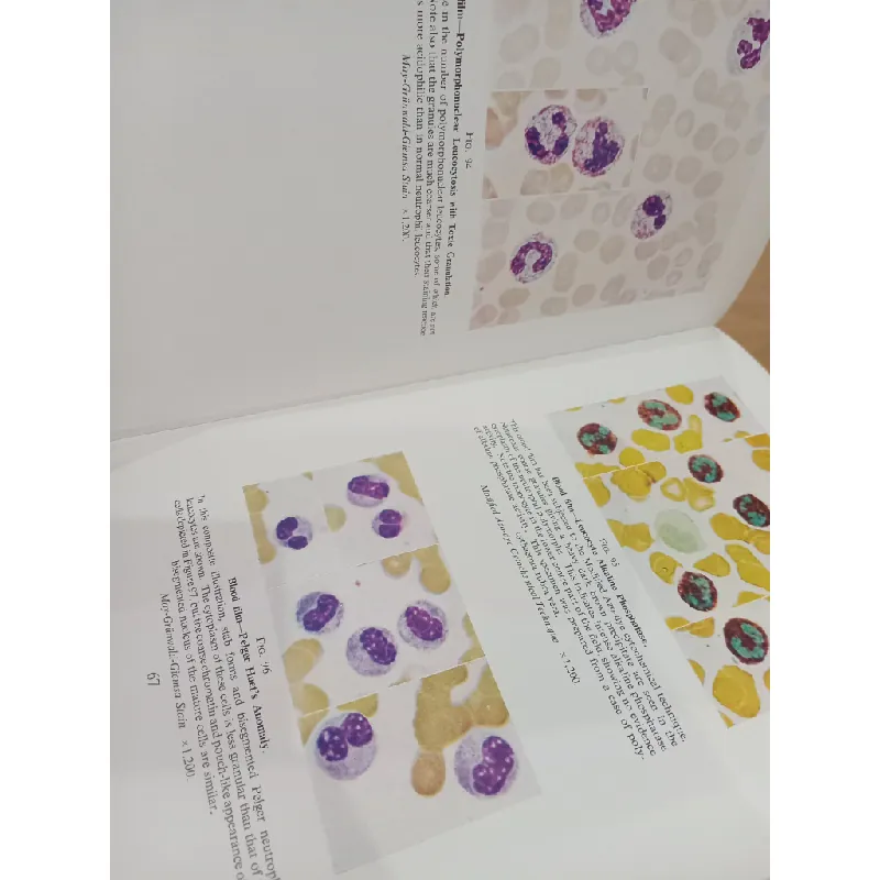 Atlas of Haematology - McDonald, Dodds, Cruickshank 575853
