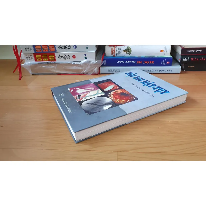 NỘI SOI MẶT TUY  754032