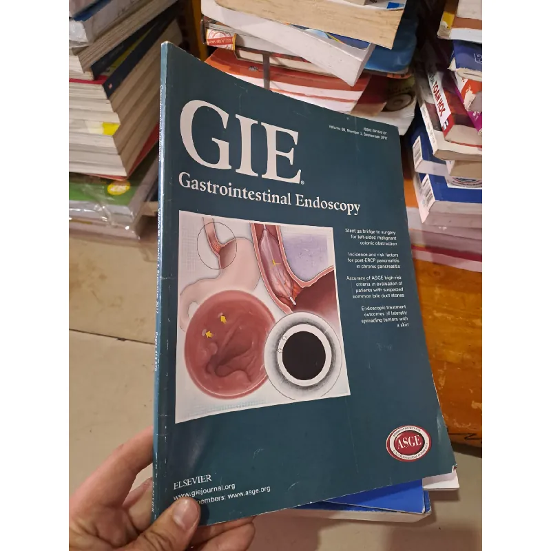 GIE Gastrointestinal Endoscopy volume 86 no 3 9/2017 HCM0808 TẠP CHÍ, THIẾT KẾ, THỜI TRANG Blogmeo21025 582054