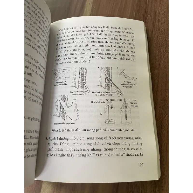 Bệnh học và điều trị ngoại khoa: Lồng ngực, tim mạch, thần kinh  795849