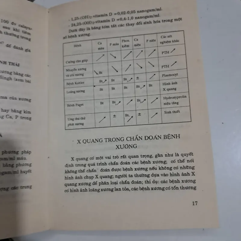 Bệnh thấp khớp 995572